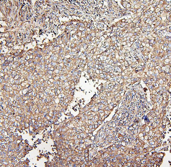 MVP Antibody (monoclonal, 8B12)