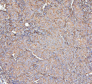 MVP Antibody (monoclonal, 8B12)