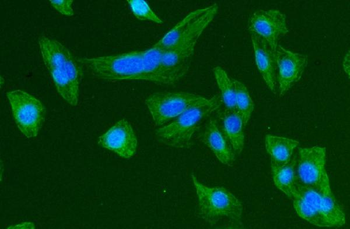 Beta Tubulin TUBB Mouse Monoclonal Antibody
