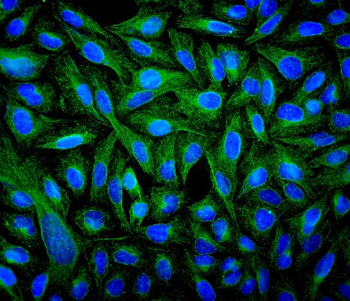 Beta Tubulin TUBB Mouse Monoclonal Antibody