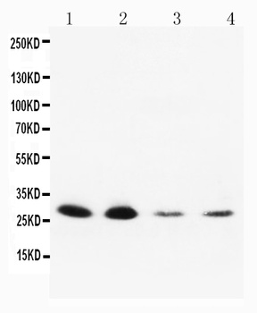 Neurotrophin 3/NTF3 Rabbit Polyclonal Antibody