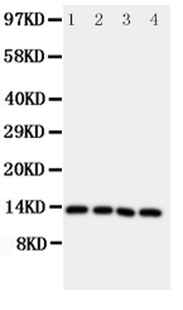 Somatostatin/SST Rabbit Polyclonal Antibody