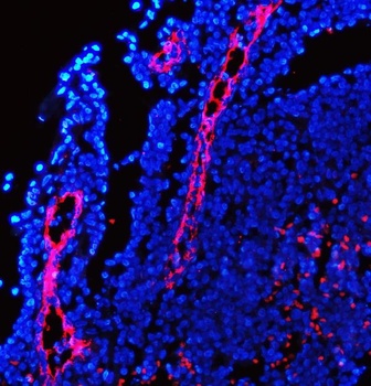 MAdCAM1 Rabbit Polyclonal Antibody