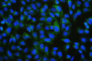 ALIX/PDCD6IP Mouse Monoclonal Antibody