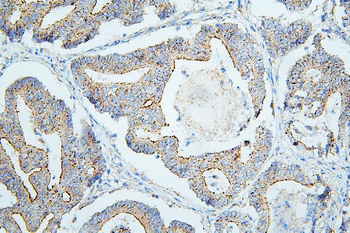 ALIX/PDCD6IP Mouse Monoclonal Antibody