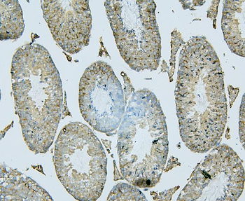 ALIX/PDCD6IP Mouse Monoclonal Antibody