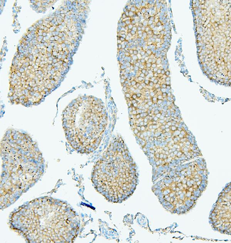 ALIX/PDCD6IP Mouse Monoclonal Antibody