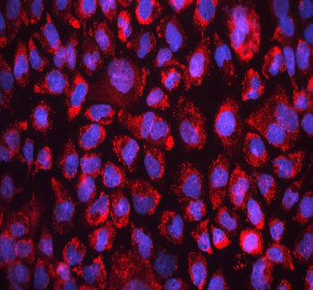 FACL4/ACSL4 Antibody