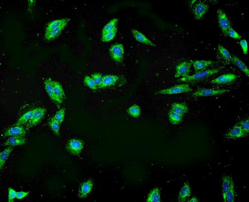 APPL/APPL1 Rabbit Polyclonal Antibody