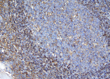 APPL/APPL1 Rabbit Polyclonal Antibody