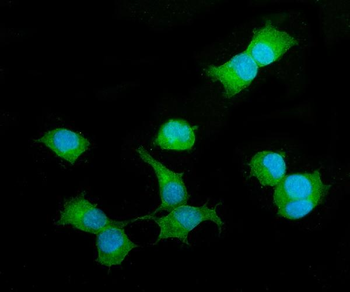 beta 2 Microglobulin/B2m Rabbit Polyclonal Antibody