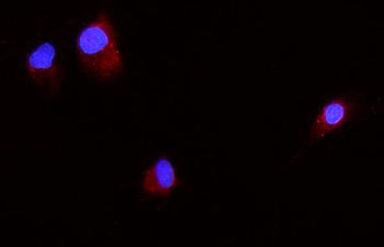 beta 2 Microglobulin/B2m Rabbit Polyclonal Antibody