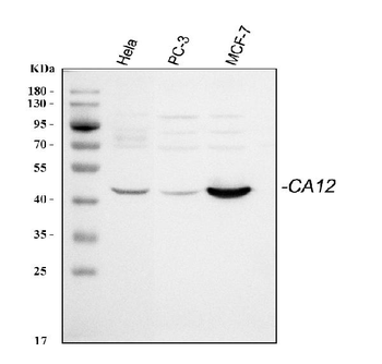 CA12 Rabbit Polyclonal Antibody
