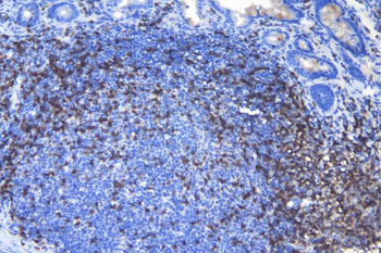 CD3 epsilon/Cd3e Antibody