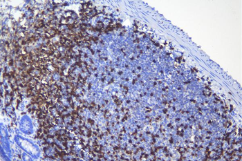 CD5 Antibody