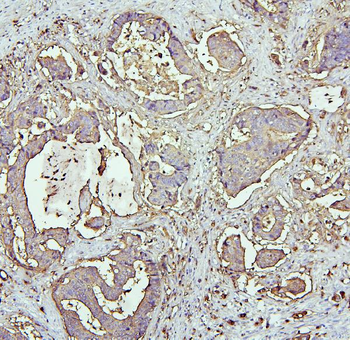 CEACAM5 Antibody