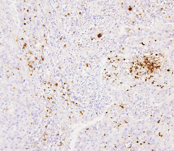 CEACAM5 Antibody