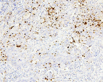 CEACAM5 Antibody