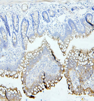 CEACAM5 Antibody