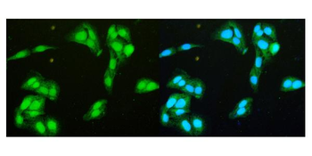 DDX1 Rabbit Polyclonal Antibody