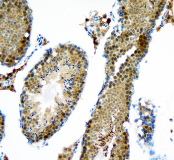 DDX1 Rabbit Polyclonal Antibody