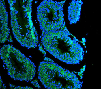 DDX4/MVH Rabbit Polyclonal Antibody