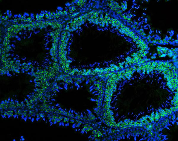 DDX4/MVH Rabbit Polyclonal Antibody