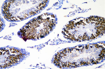 DDX4/MVH Rabbit Polyclonal Antibody