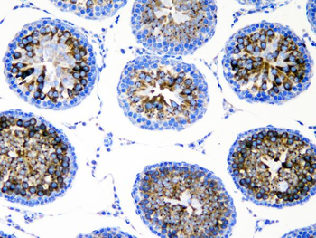 DDX4/MVH Rabbit Polyclonal Antibody