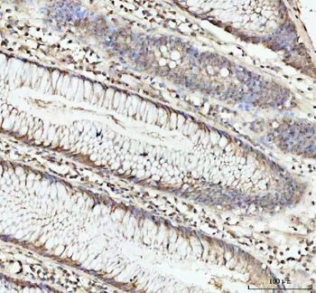 DHX15/prp43 Rabbit Polyclonal Antibody