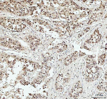 DHX15/prp43 Rabbit Polyclonal Antibody