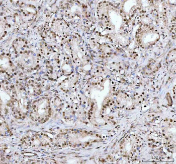 DHX15/prp43 Rabbit Polyclonal Antibody