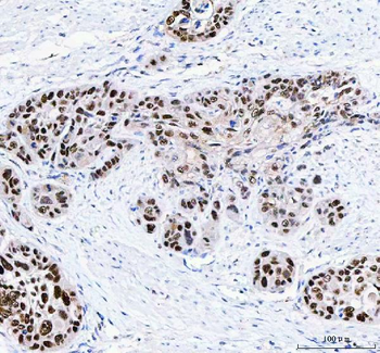 FEN1 Rabbit Polyclonal Antibody