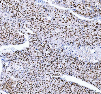 FEN1 Rabbit Polyclonal Antibody