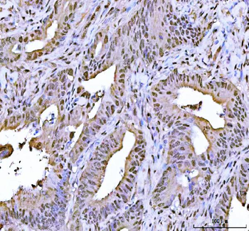 FEN1 Rabbit Polyclonal Antibody