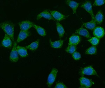 GLB1/Beta-galactosidase Antibody