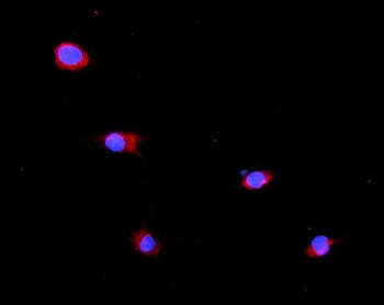 GLB1/Beta-galactosidase Antibody