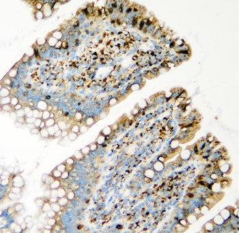 GLB1/Beta-galactosidase Antibody