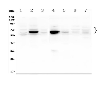 GLB1/Beta-galactosidase Antibody