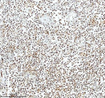 Histone H3 HIST1H3A/B/C/D/E/F/G/H/I/J Antibody