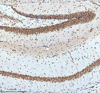 Histone H3 HIST1H3A/B/C/D/E/F/G/H/I/J Antibody