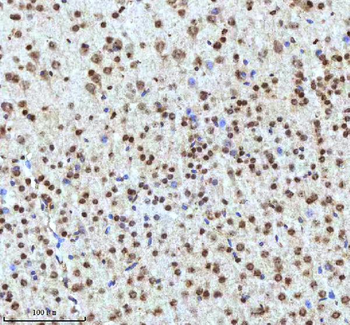 Histone H3 HIST1H3A/B/C/D/E/F/G/H/I/J Antibody