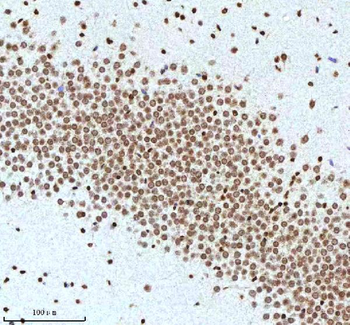 Histone H3 HIST1H3A/B/C/D/E/F/G/H/I/J Antibody