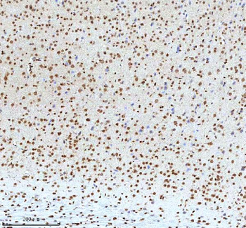 Histone H3 HIST1H3A/B/C/D/E/F/G/H/I/J Antibody