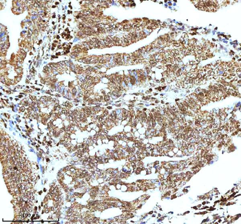 Histone H3 HIST1H3A/B/C/D/E/F/G/H/I/J Antibody