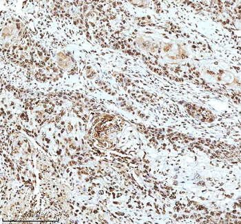 Histone H3 HIST1H3A/B/C/D/E/F/G/H/I/J Antibody