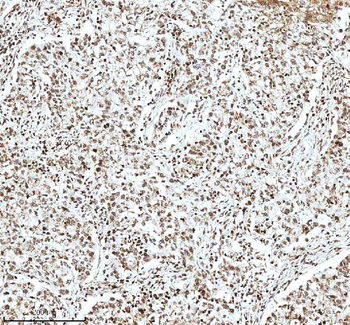 Histone H3 HIST1H3A/B/C/D/E/F/G/H/I/J Antibody