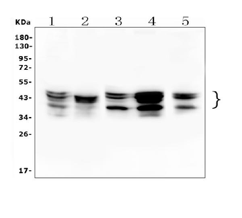 hnRNP D/AUF1/HNRNPD Rabbit Polyclonal Antibody