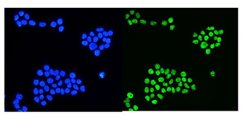 hnRNP D/AUF1/HNRNPD Rabbit Polyclonal Antibody