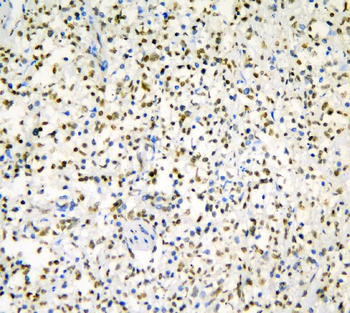 hnRNP D/AUF1/HNRNPD Rabbit Polyclonal Antibody